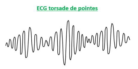 trazado ECG torsade pointes