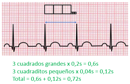frecuencia cardíaca en el electrocardiograma